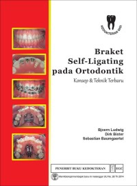 Braket Self-Ligating pada Ortodontik : Konsep & Teknik Terbaru