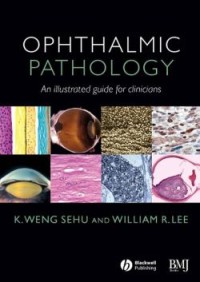 Ophthalmic Pathology : An Illustrated Guide for Clinicians