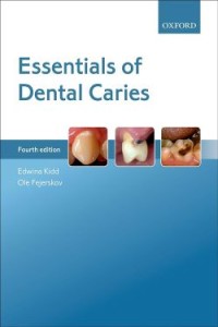 Image of Essentials of Dental Caries