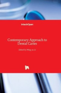 Image of Contemporary Approach to Dental Caries