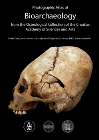 Photographic Atlas of Human Bioarchaeology from the Osteological Collections of the Croatian Academy of Science