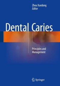Image of Dental Caries: Principles and Management