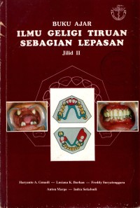 Buku Ajar Ilmu Geligi Tiruan Sebagian Lepasan jilid 2