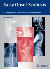 Image of Early Onset Scoliosis:acomprehensive guide from the Oxford meetings
