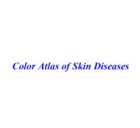 Color Atlas of Skin Diseases